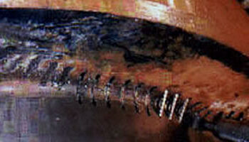 metal stitching